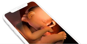 Fetal Imagery Through Smartphone PNG