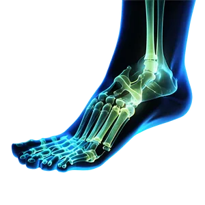 Foot Bones X-ray Png 2 PNG image