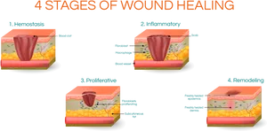 Four Stagesof Wound Healing Graphic PNG