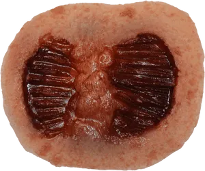 Healing Surgical Wound Closeup.png PNG