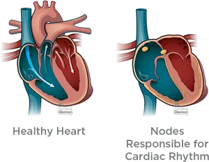 Healthy Heartand Cardiac Rhythm Nodes