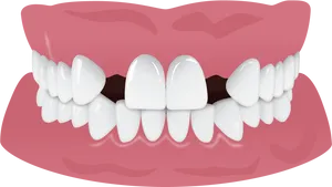 Healthy Teeth Illustration.png PNG image