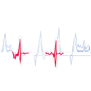 Heartbeat Ekg For Fitness PNG 9 PNG