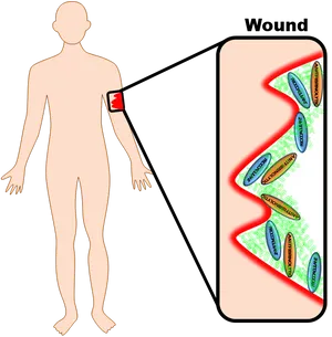 Human Anatomy Wound Diagram PNG