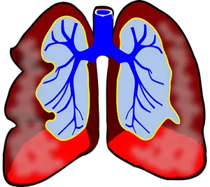 Human Lungs Illustration PNG image