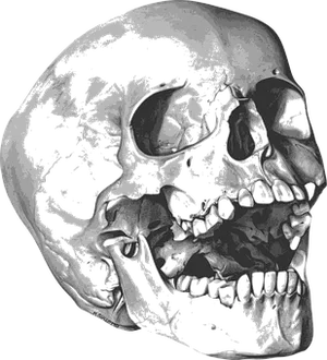 Human Skull Xray Image