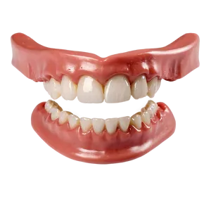 Immediate Dentures Picture Png 06272024 PNG image