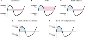 Inhalation Exhalation Flow Graphs