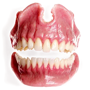 Innovative Dentures Solutions Png Bdc PNG image