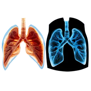 Lungs Under X-ray Png 05232024 PNG image