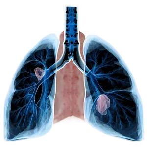 Lungs Under X-ray Png 05232024 PNG image