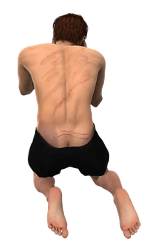 Man_with_ Scars_on_ Back