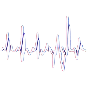 Medical Heartbeat Line Png 51 PNG image