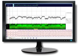 Medical Monitor Displaying Heart Rateand Sleep Data PNG image