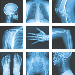 Medical_ X Ray_ Collage PNG image