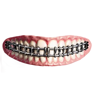 Mouth With Braces Png Gpa67 PNG image