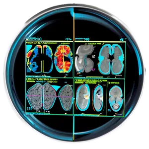 Mri Data Analysis PNG Fqd19