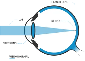 Normal Vision Light Refraction Diagram PNG image