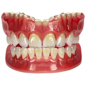 Partial Dentures Graphic Png Mnw PNG image