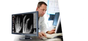 Radiologist Analyzing Hand Xray PNG image