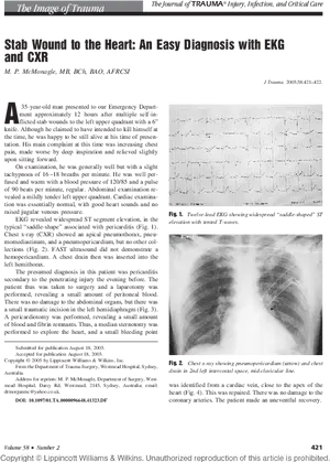 Stab Wound Diagnosiswith E K Gand C X R PNG image