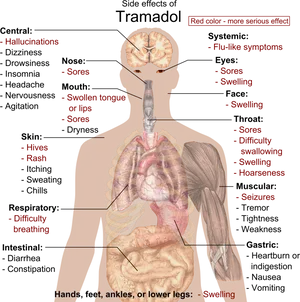 Tramadol Side Effects Human Body Illustration PNG image