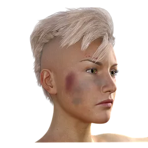 Womanwith Bruisesand Scars
