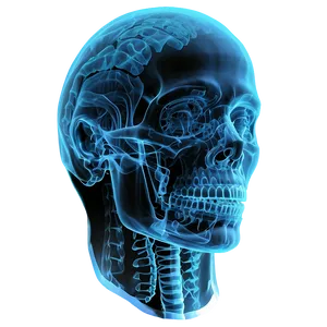 X Ray Of Human Head Png 90 PNG image