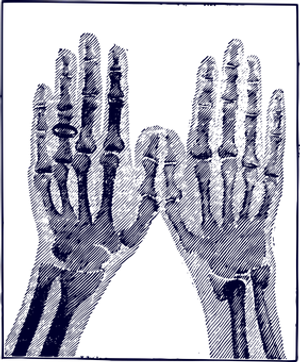 Xray Hands Bones Outline PNG