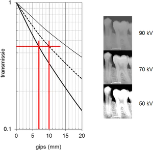 Xray Transmission Graphand Dental Imaging Comparison PNG image